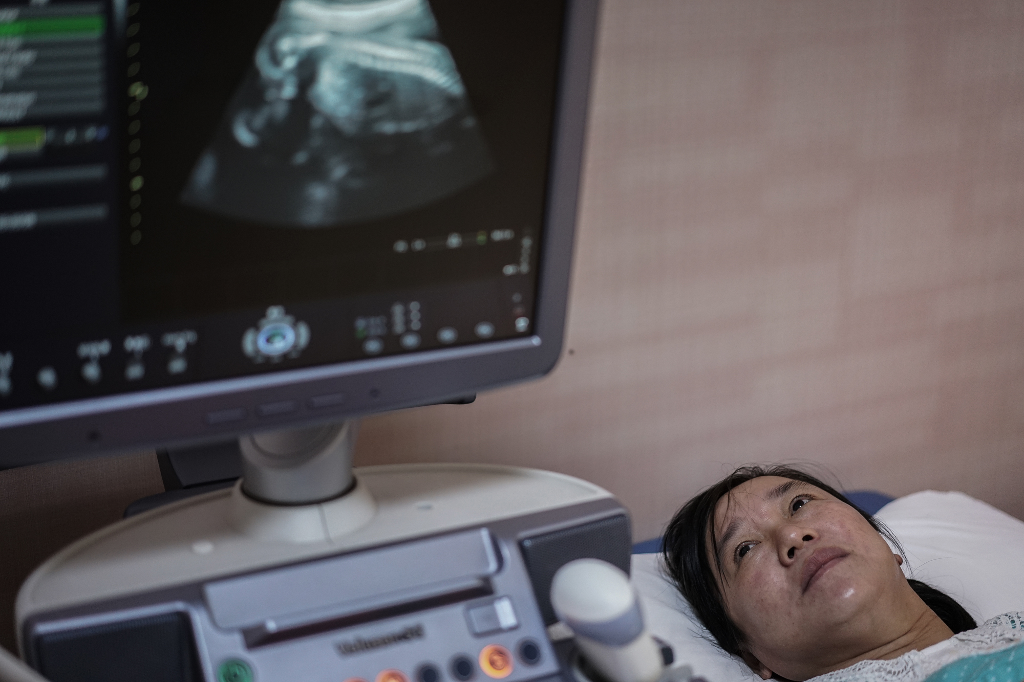 In April 2016, they attempted their first in vitro fertilization (IVF) cycle. It failed. In China, the IVF success rate is less than 5 percent. On the fourth attempt, good news finally arrived, and in May 2017, Zhiying became pregnant. Zhiying sees an image of her twins for the first time during an ultrasound exam at a military hospital in Wuhan, the capital of Hubei, October 3, 2017. 