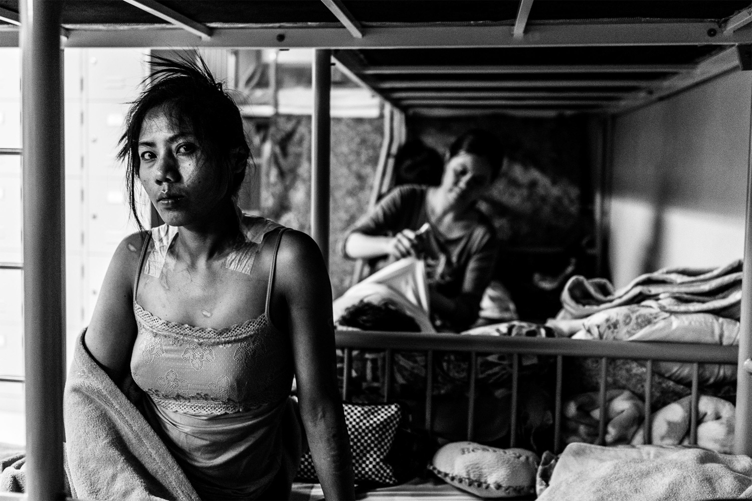 Shirley Dalisay, 31, from the Philippines, suffered from burns on her back and arms when a pot of boiling hot soup fell on her after her employer “accidentally” put the soup above the family’s shoe rack where Shirley stored her shoes.
