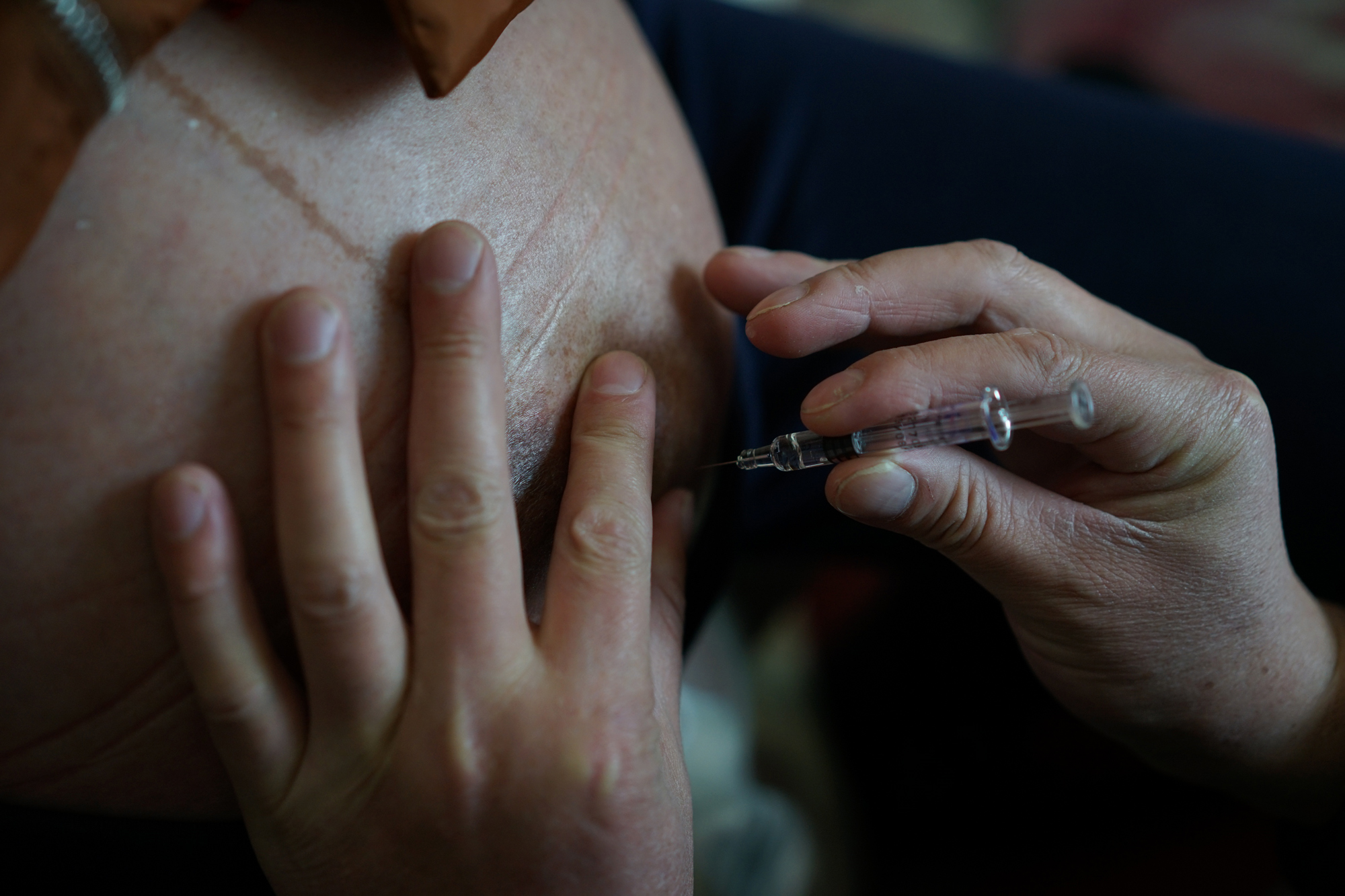 Zhiying had to receive a daily injection during the IVF process and pregnancy to prevent blood clots. Fangguo injects medicine into Zhiying’s abdomen at home in Suizhou, November 23, 2017.