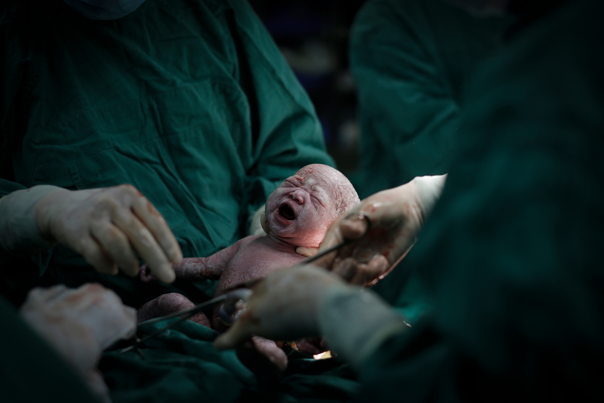 A few minutes later, her first baby is born. It’s a boy. Her second baby, a girl, is born two minutes after. 