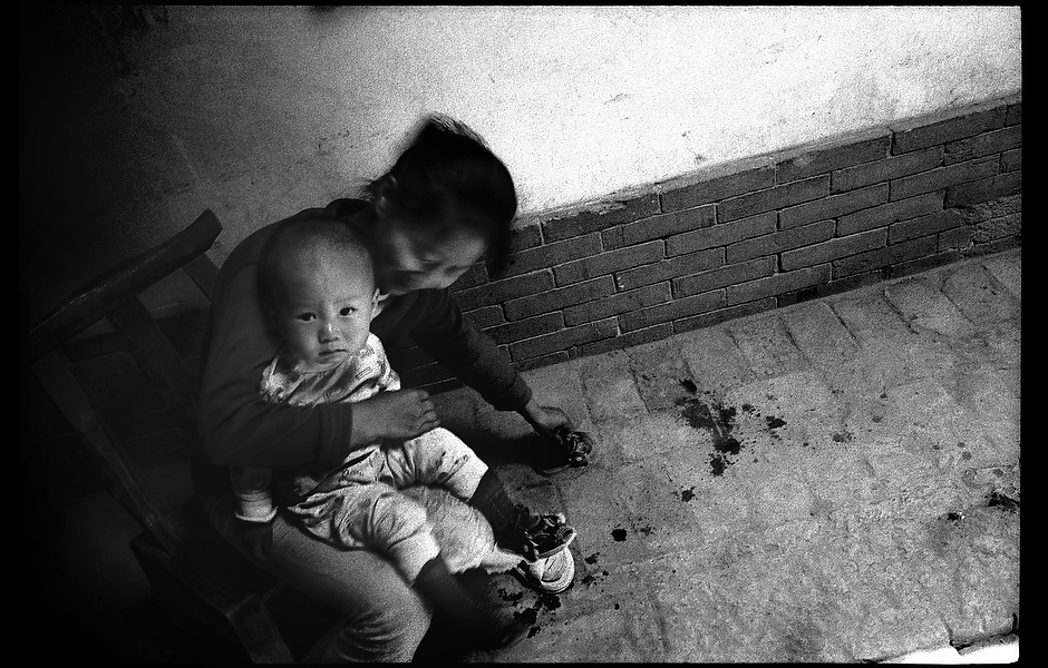 Xiao Shan gets her one year old son, Cha Li, ready for his final hepatitis B vaccination. While a safe and effective vaccine to prevent hepatitis B has existed for over twenty years, few people actually receive all three injections required to provide immunity. Shaanxi, China